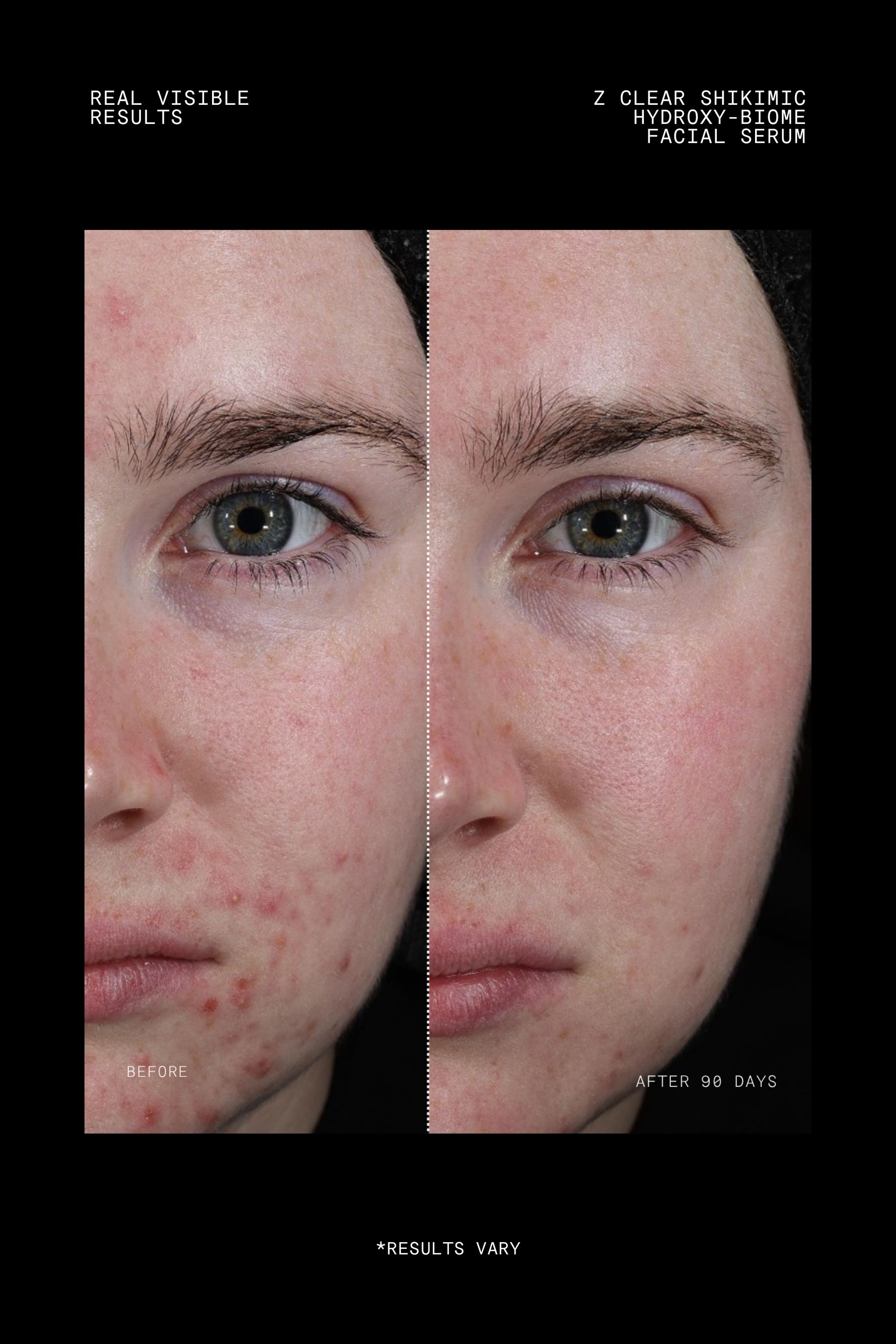 Z Clear Shikimic Hydroxy-Biome Facial Serum