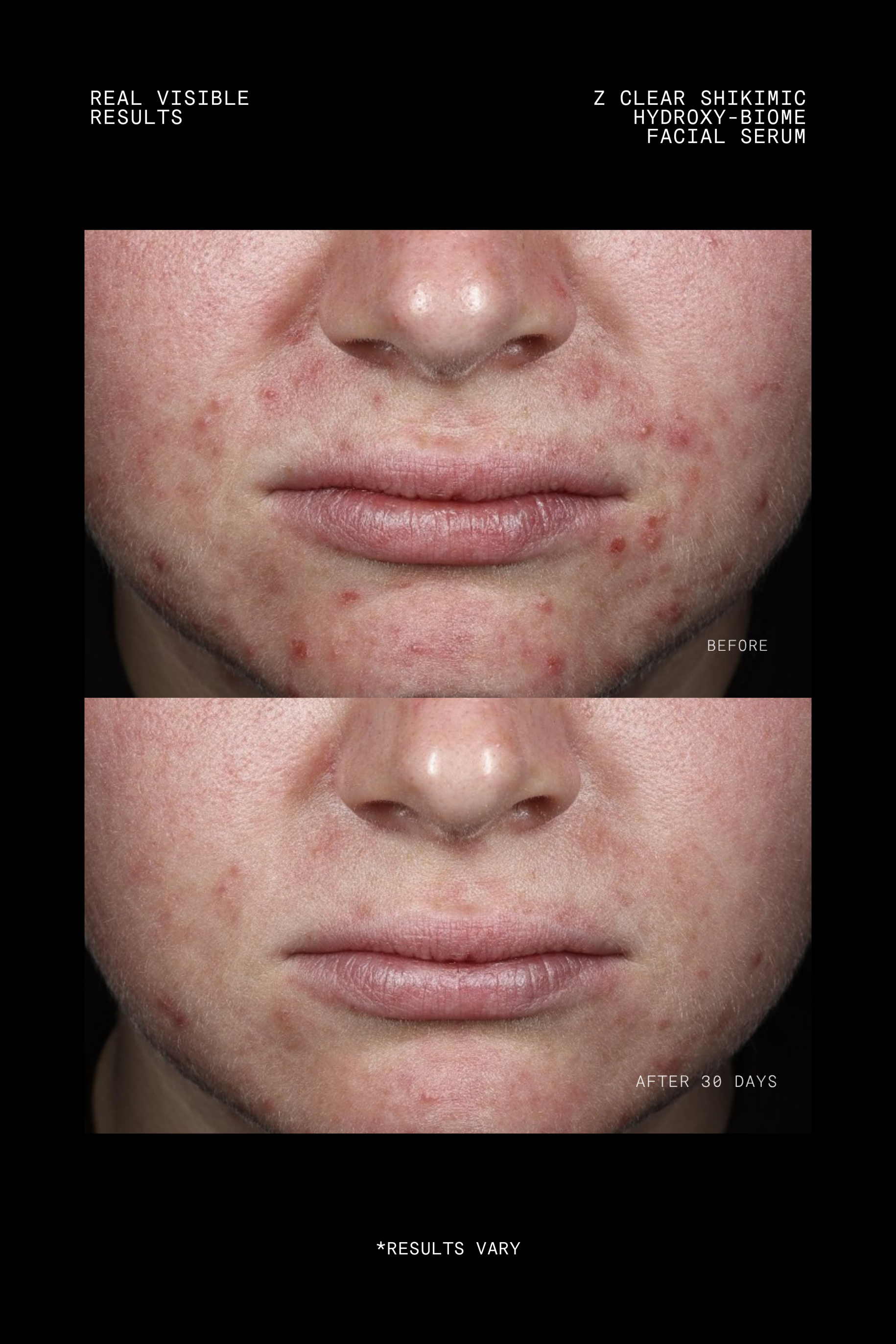 Z Clear Shikimic Hydroxy-Biome Facial Serum