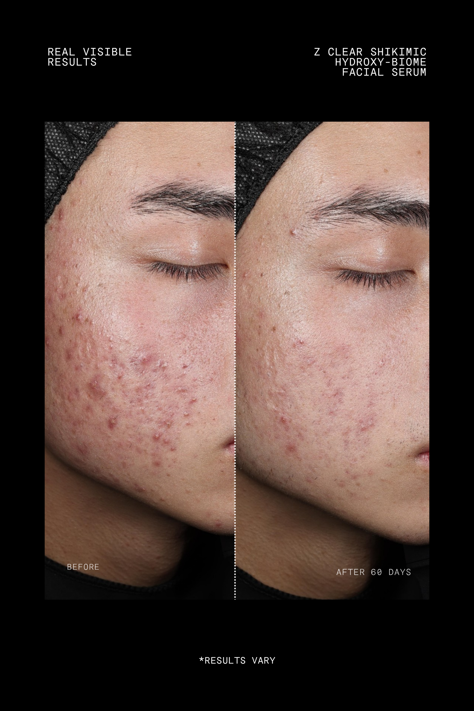 Z Clear Shikimic Hydroxy-Biome Facial Serum
