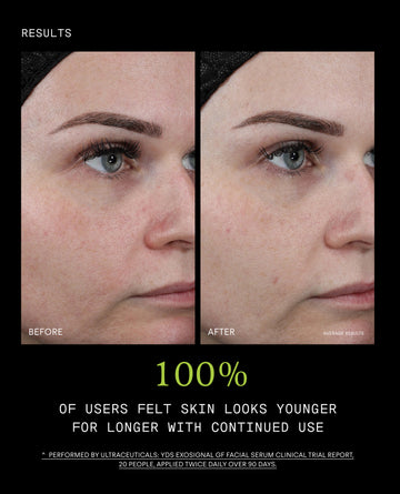 Youth Boost ExoSignal GF² Facial Serum