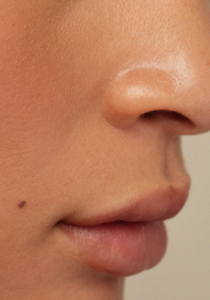 Ultraceuticals for transformational skin